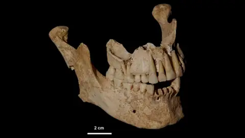 La mandíbula de Filipo II de Macedonia La mandíbula de Filipo II de Macedonia