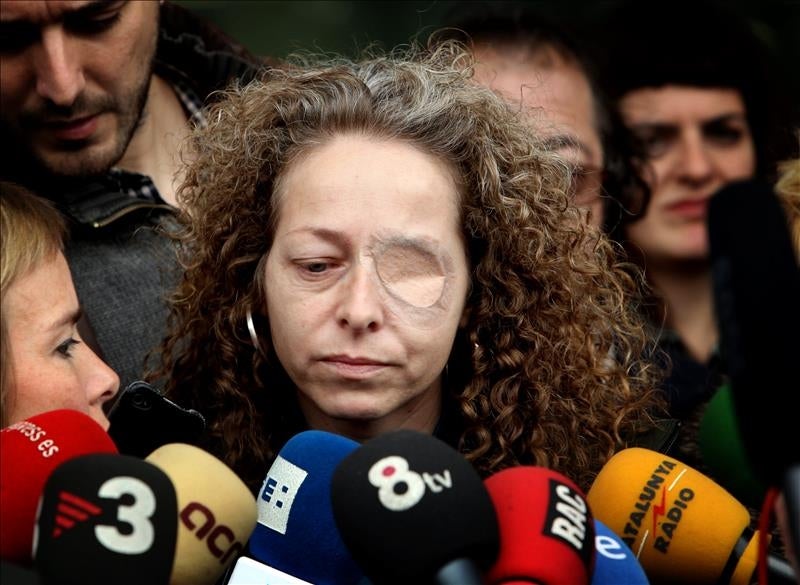 La Generalitat indemniza con 260.931€ a la mujer perdió un ojo por una actuación policial La Generalitat indemniza con 260.931€ a la mujer perdió un ojo por una actuación policial