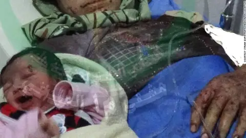 Imagen de la bebé recién nacida difundida por los médicos que la trataron Imagen de la bebé recién nacida difundida por los médicos que la trataron