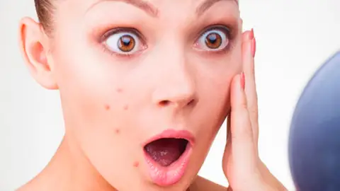 Chica con granos Chica con granos