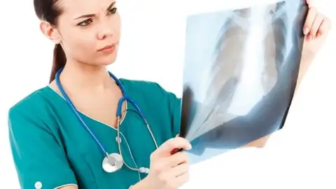 Cáncer de pulmón Cáncer de pulmón