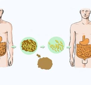 na nueva técnica podría mejorar el trasplante de microbiota intestinal na nueva técnica podría mejorar el trasplante de microbiota intestinal