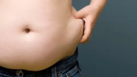Acumulación de grasa abdominal Acumulación de grasa abdominal