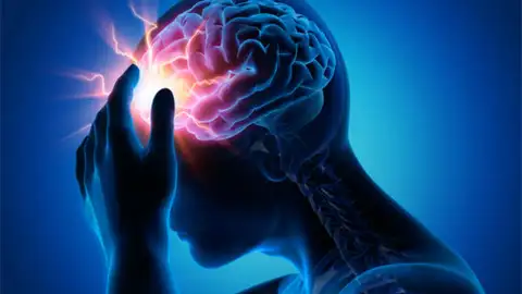 La epilepsia, una enfermedad que puede controlarse gracias a los fármacos La epilepsia, una enfermedad que puede controlarse gracias a los fármacos