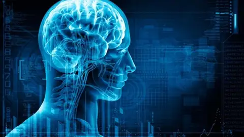 Ictus hemorrágico Ictus hemorrágico