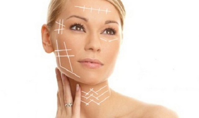 30ytantos: ¿Que son los Hilos rejuvenecedores? 30ytantos: ¿Que son los Hilos rejuvenecedores?