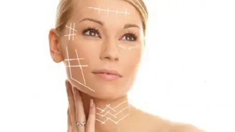 Hilos japoneses. Hilos japoneses.