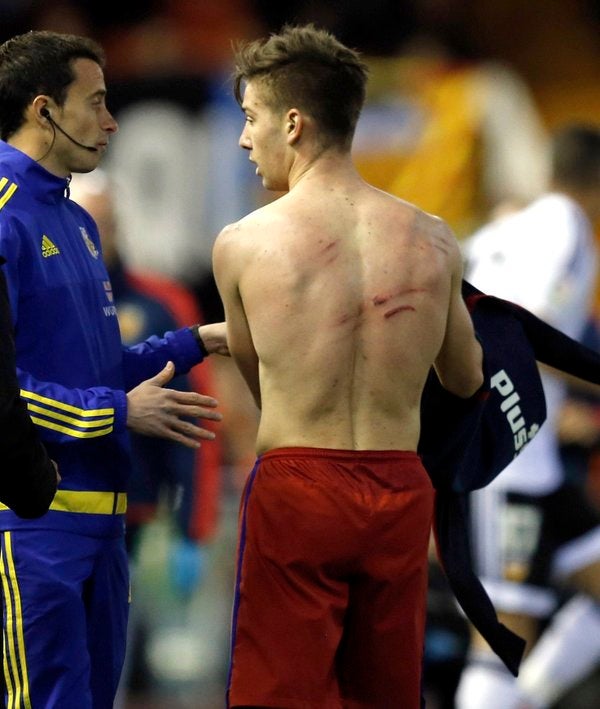 Nadie falla en la parte alta Nadie falla en la parte alta