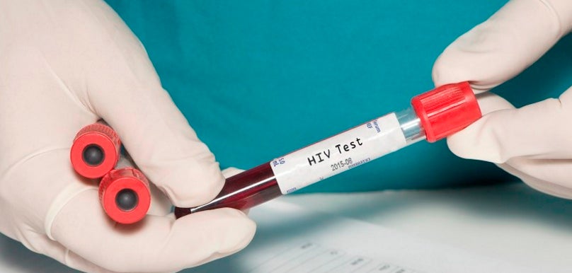 La prueba del VIH se podrá comprar en farmacias sin prescripción médica La prueba del VIH se podrá comprar en farmacias sin prescripción médica