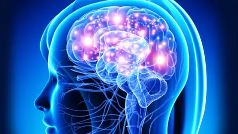 Cerebro Cerebro