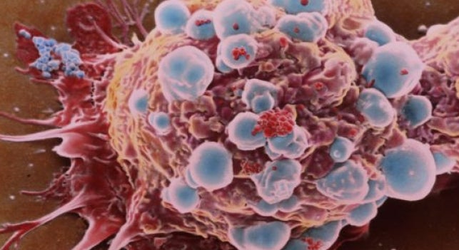 La inmunoterapia abre la puerta a una vacuna universal contra el cáncer La inmunoterapia abre la puerta a una vacuna universal contra el cáncer