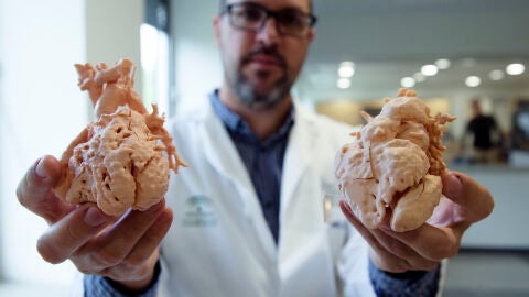 Corazones impresos a tama&ntilde;o real en 3D para planificar la intervenci&oacute;n en ni&ntilde;os