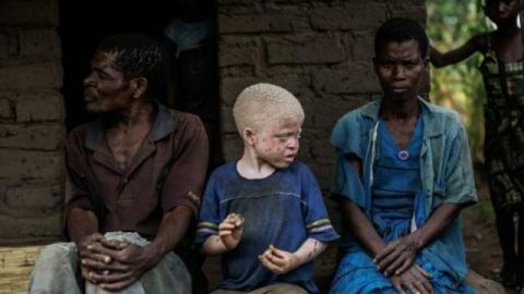 Negros Albinos.
