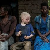 Negros Albinos.