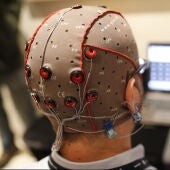 Estimulación eléctrica cerebral con electrodos