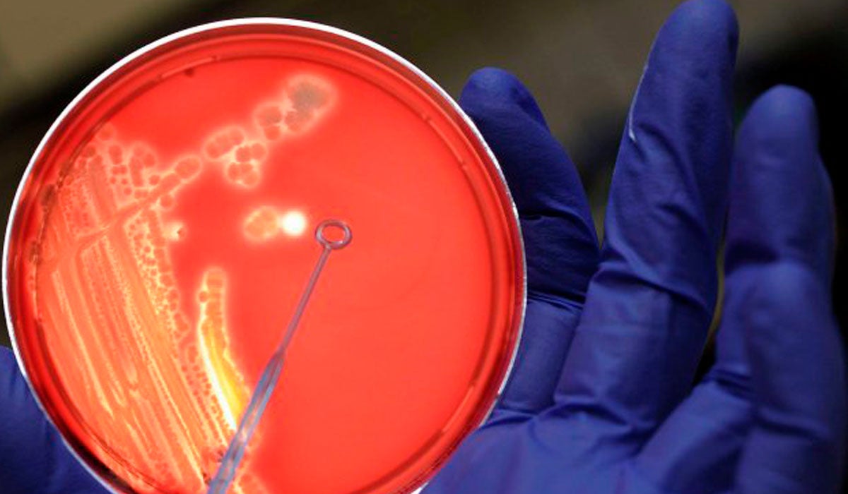 La ONU luchará para evitar la amenaza mundial de las superbacterias La ONU luchará para evitar la amenaza mundial de las superbacterias