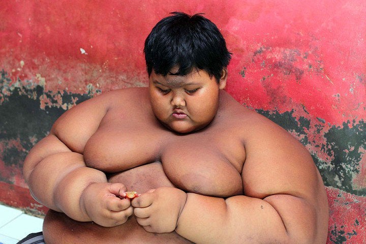 Un indonesio de 10 años es el niño más gordo del mundo con 192 kilos Un indonesio de 10 años es el niño más gordo del mundo con 192 kilos