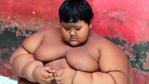 A sus 10 a&ntilde;os, Arya Permana pesaba 200 kilos.