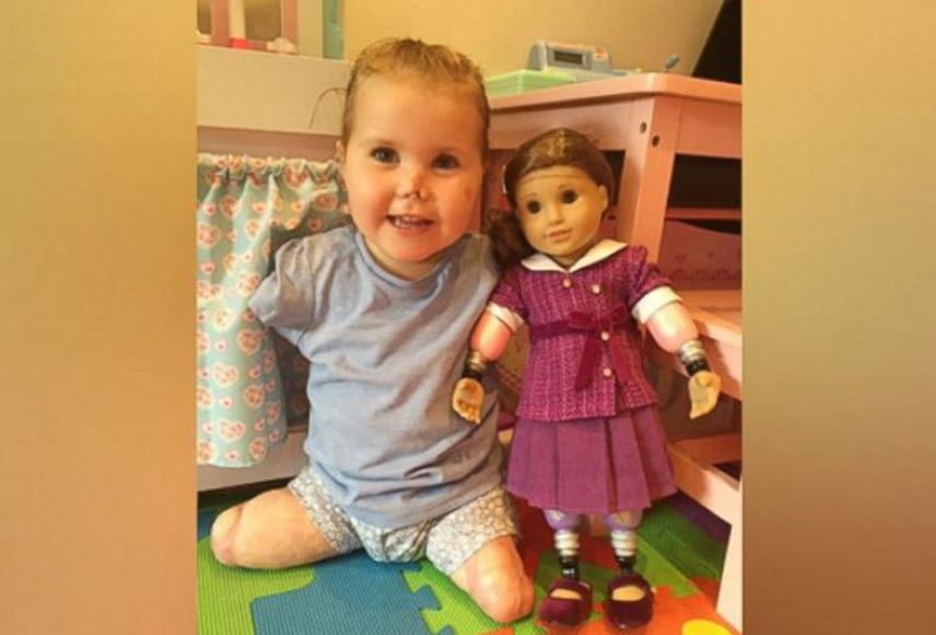 Regalan a una niña sin brazos ni piernas una muñeca con extremidades amputadas: "Es como yo" Regalan a una niña sin brazos ni piernas una muñeca con extremidades amputadas: "Es como yo"