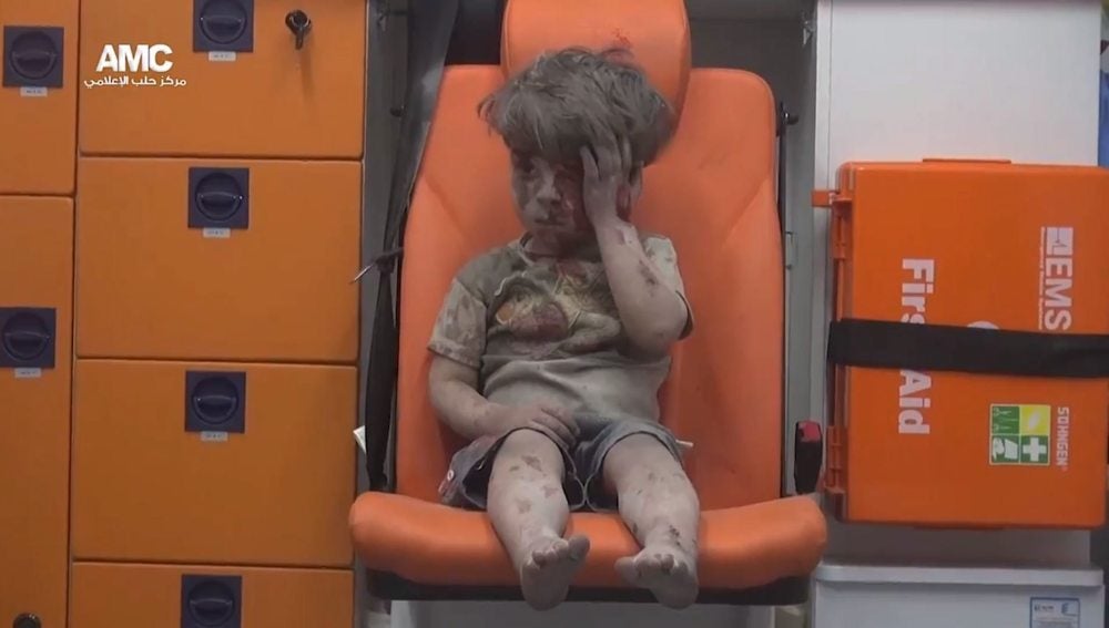 Omran, la cara de la guerra de Siria