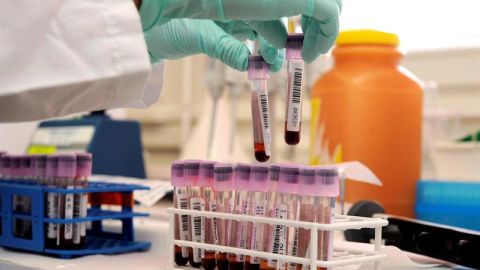 Fiebre Hemorr&aacute;gica