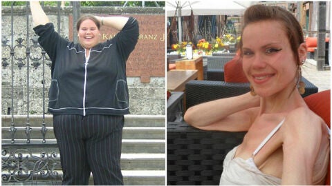 Lisa Milburn antes y despu&eacute;s