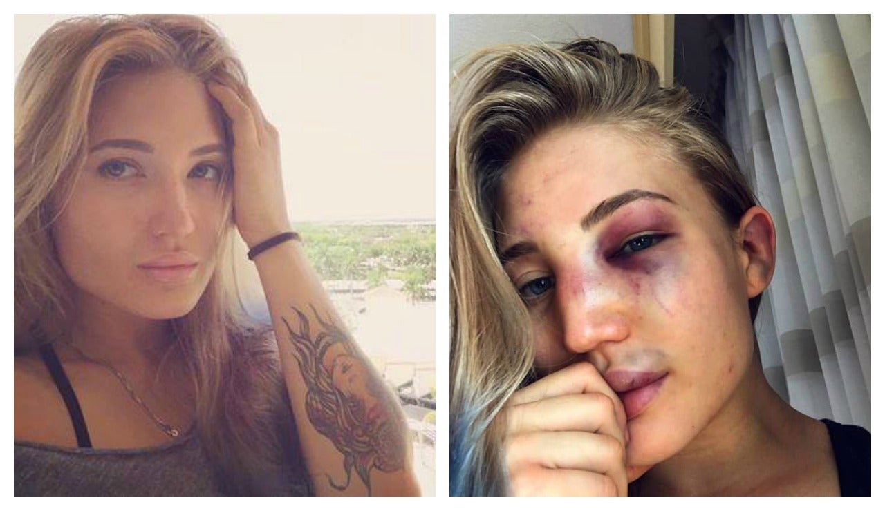 La reina de las artes marciales mixtas muestra cómo quedó su rostro tras un combate: "Esto es MMA, nene" La reina de las artes marciales mixtas muestra cómo quedó su rostro tras un combate: "Esto es MMA, nene"