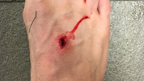 El pie de Filipe Luis, despu&eacute;s de recibir la entrada de Luis Su&aacute;rez
