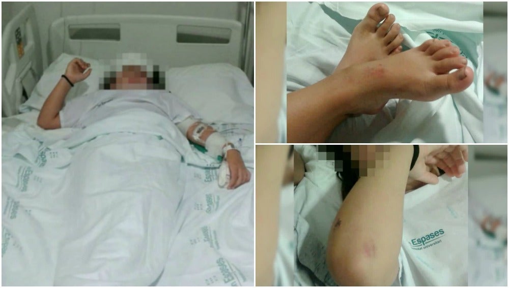 El abogado de la niña agredida en Palma denunciará por homicidio en grado de tentativa El abogado de la niña agredida en Palma denunciará por homicidio en grado de tentativa