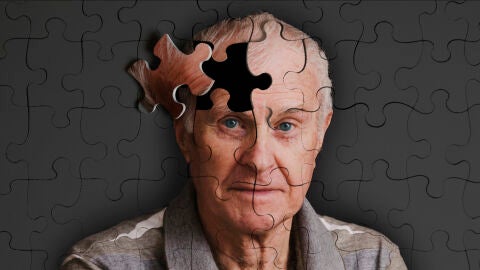 Diez claves para detectar el Alzheimer 
