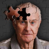 Diez claves para detectar el Alzheimer 