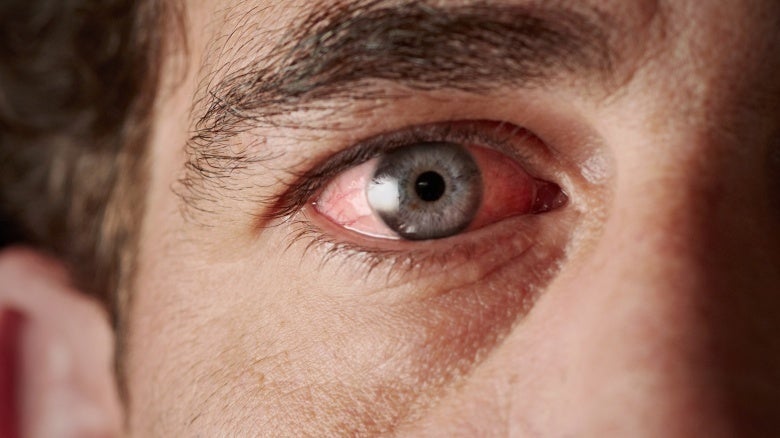La primavera, los ojos altera La primavera, los ojos altera