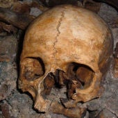 Imagen de archivo de restos humanos