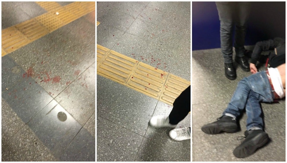Incidentes entre ultras de Besiktas y Nápoles en Estambul: un aficionado italiano fue apuñalado Incidentes entre ultras de Besiktas y Nápoles en Estambul: un aficionado italiano fue apuñalado