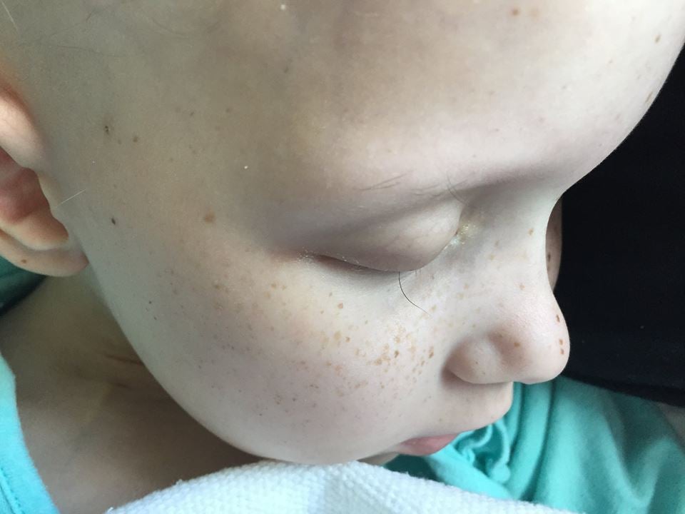 La conmovedora fotografía de una niña enferma de cáncer que ha perdido sus pestañas La conmovedora fotografía de una niña enferma de cáncer que ha perdido sus pestañas