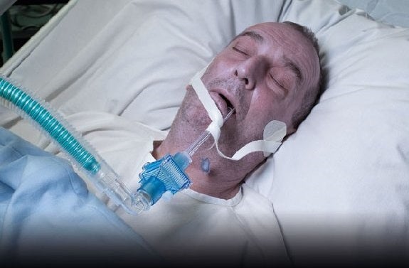 Un hombre denuncia el uso de su imagen tras una operación en las cajetillas de tabaco sin su consentimiento Un hombre denuncia el uso de su imagen tras una operación en las cajetillas de tabaco sin su consentimiento