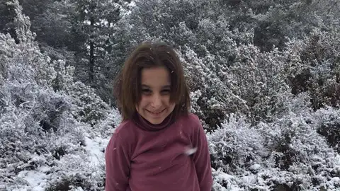 Nadia, la niña con envejecimiento prematuro Nadia, la niña con envejecimiento prematuro