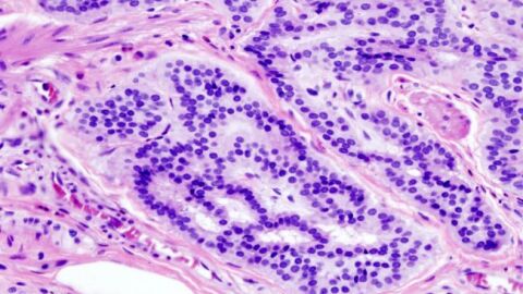 Cient&iacute;ficos espa&ntilde;oles ensayar&aacute;n en 2017 un anticuerpo humanizado contra varios tumores cancer&iacute;genos