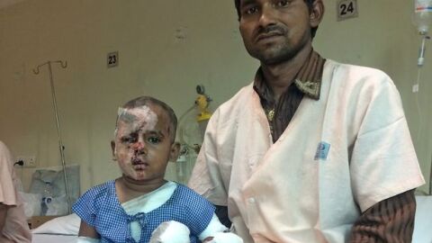 El ni&ntilde;o atacado junto a su cirujano