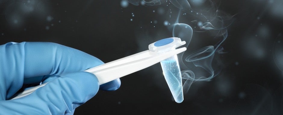 La calidad del esperma de los hombres se ha reducido a la mitad en los últimos 40 años La calidad del esperma de los hombres se ha reducido a la mitad en los últimos 40 años