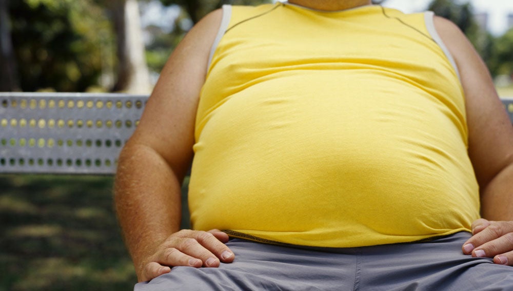 El 30% de la población mundial tiene problemas de obesidad, según un estudio El 30% de la población mundial tiene problemas de obesidad, según un estudio
