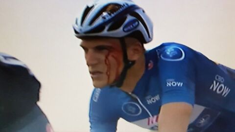 Kittel sangrando durante la carrera tras el pu&ntilde;etazo de Krivko