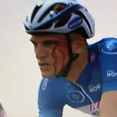 Kittel sangrando durante la carrera tras el puñetazo de Krivko Kittel sangrando durante la carrera tras el puñetazo de Krivko