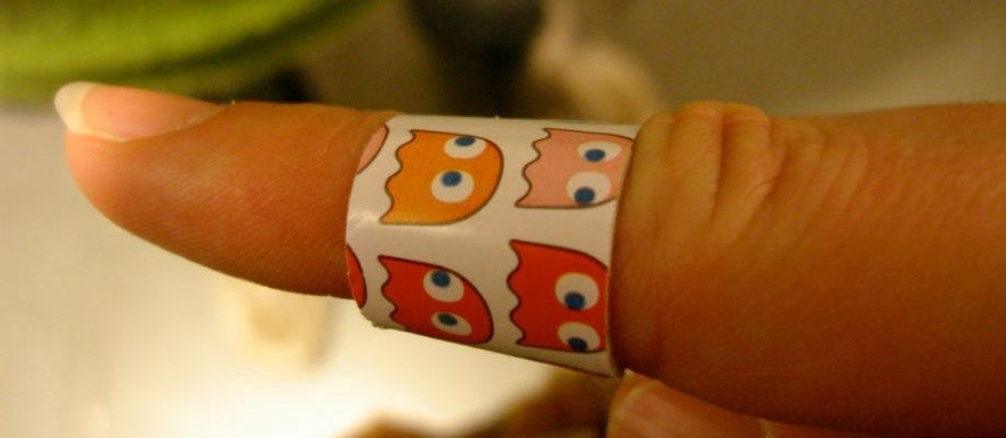 02X05: Heridas y moratones 02X05: Heridas y moratones