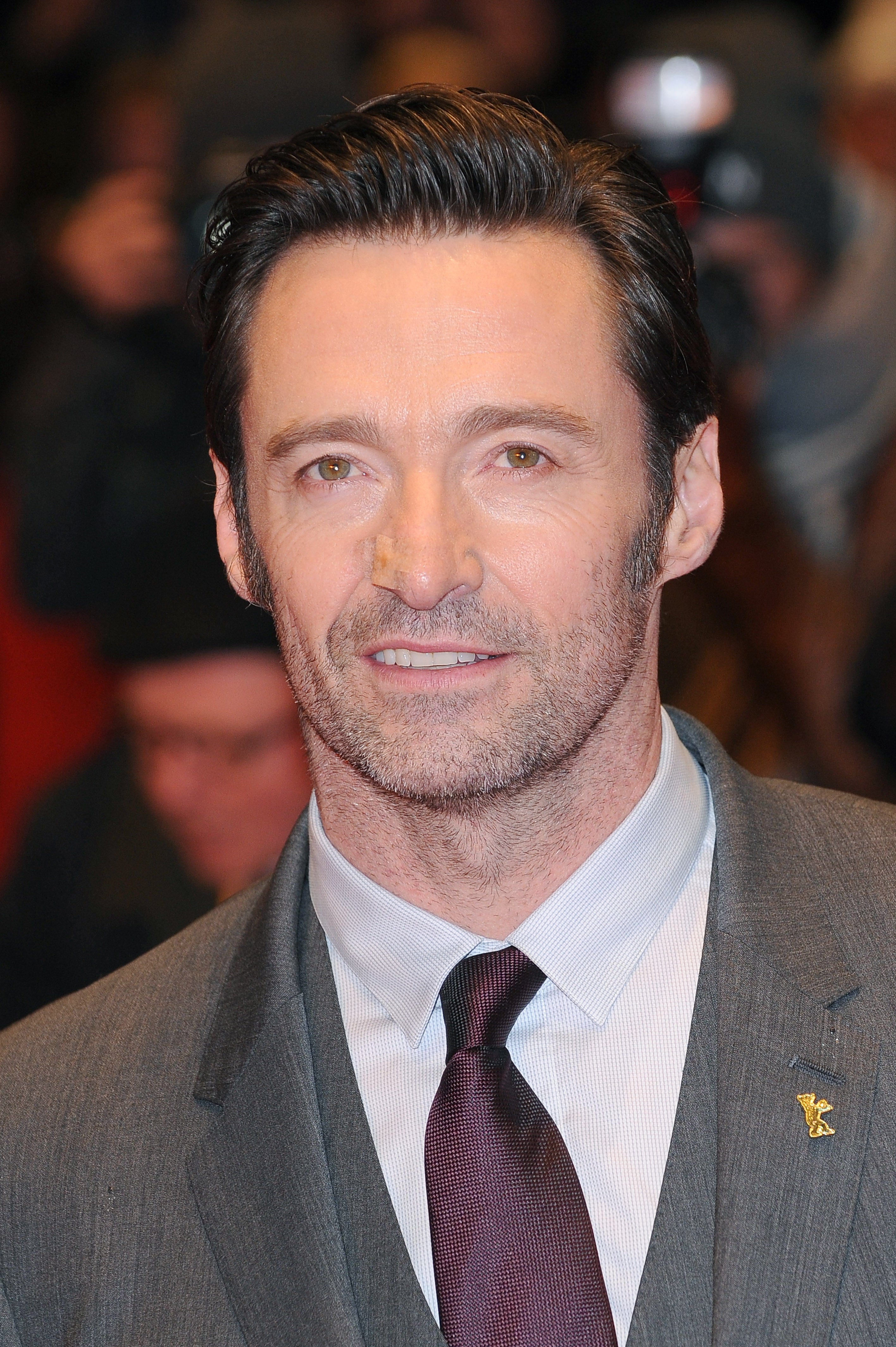 Hugh Jackman sometido a una biopsia por un posible regreso del cáncer de piel Hugh Jackman sometido a una biopsia por un posible regreso del cáncer de piel