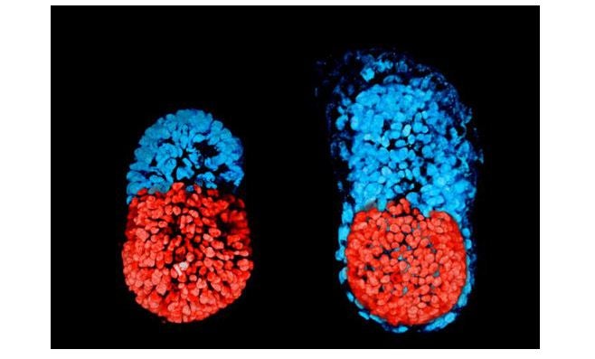 Cosas de la vida: ¿Se pueden erradicar las enfermedades? Cosas de la vida: ¿Se pueden erradicar las enfermedades?