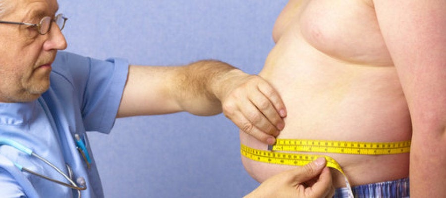 Los niños españoles con trasplante de riñón presentan una mayor prevalencia de la obesidad Los niños españoles con trasplante de riñón presentan una mayor prevalencia de la obesidad