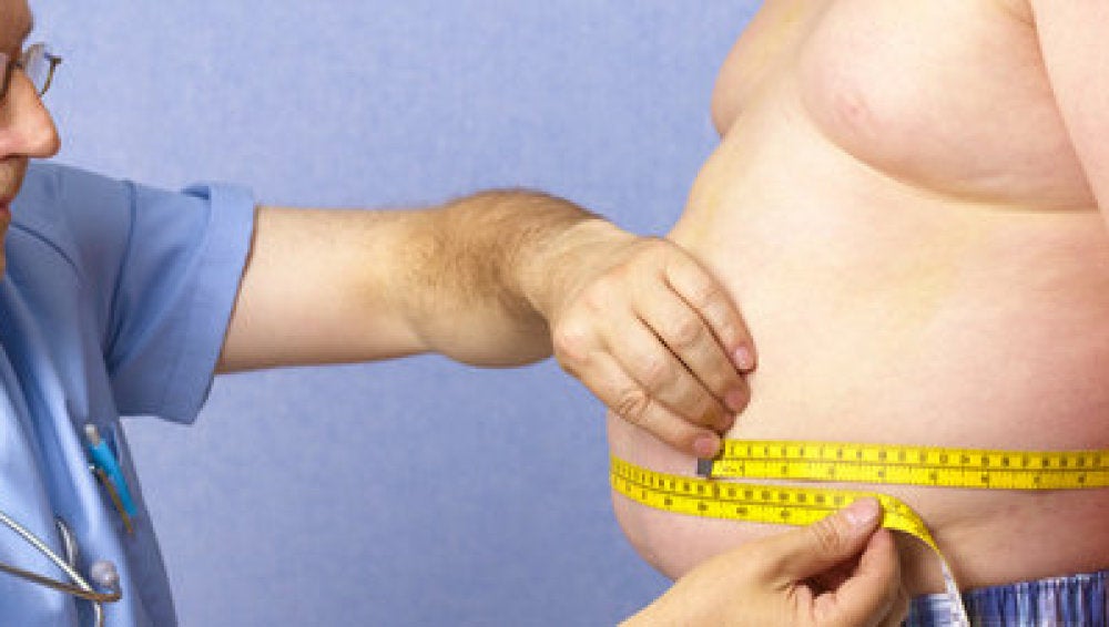 Los niños españoles con trasplante de riñón presentan una mayor prevalencia de la obesidad