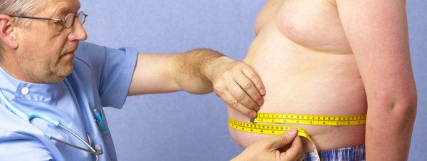 Las personas obesas tienen tres veces más riesgo de sufrir un deterioro cognitivo Las personas obesas tienen tres veces más riesgo de sufrir un deterioro cognitivo