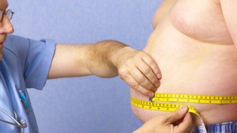 Los ni&ntilde;os espa&ntilde;oles con trasplante de ri&ntilde;&oacute;n presentan una mayor prevalencia de la obesidad